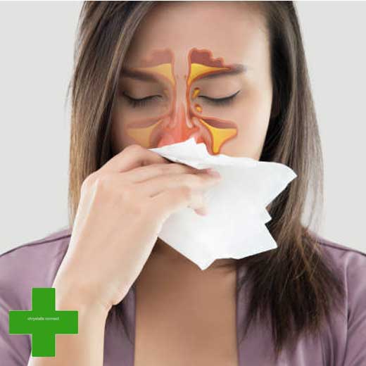 Acute Sinusitis